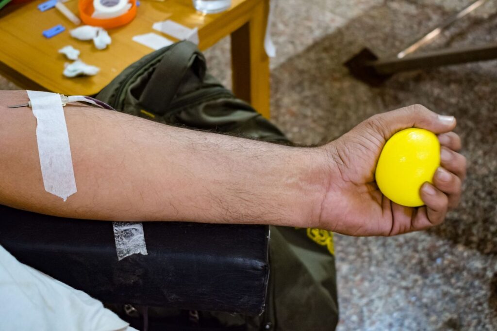 A taped arm and a stress ball during a treatment