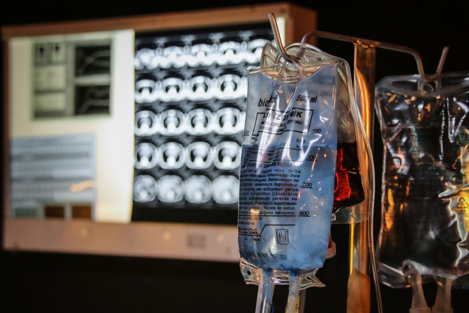 IV fluid bags hanging on a stand