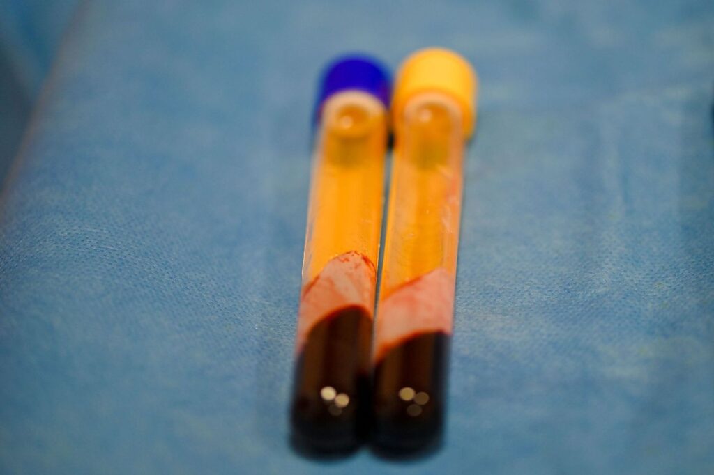Two blood sample tubes